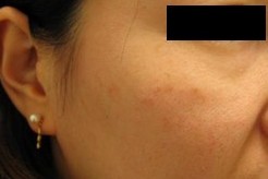 after after