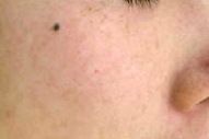 before before
